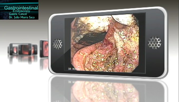 Gastroenterologia El Salvador