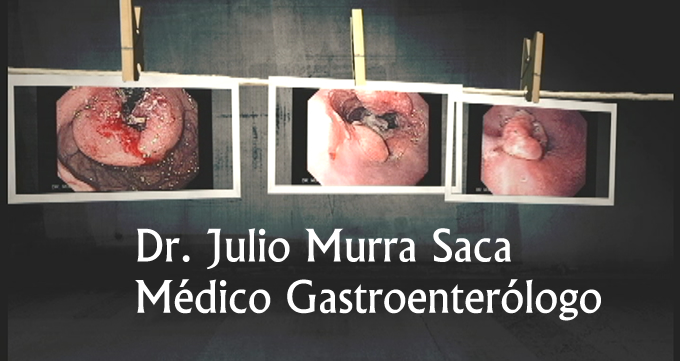 Gastroenterologia El Salvador