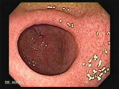 Gastroenterologia Santa Ana