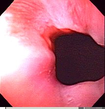 Gastroenterologo Sana Ana