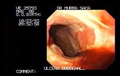 Endoscopia El Salvador